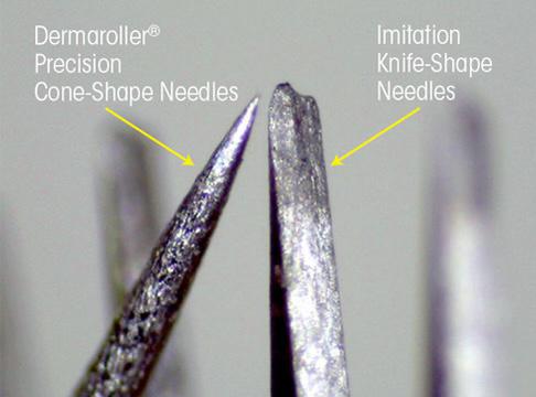 Microneedling
